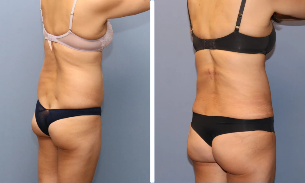Case_ LIPO-002 (2)