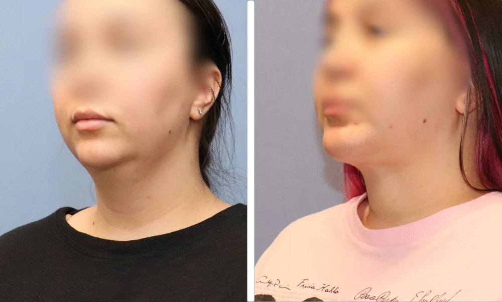 Neck-001 (5)