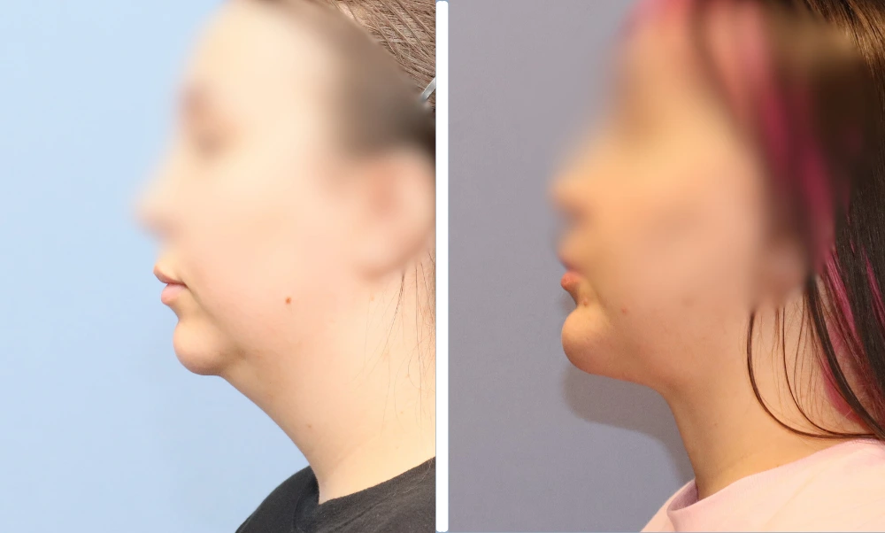 Neck-001 (6)
