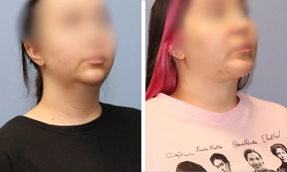 Neck-001 (8)