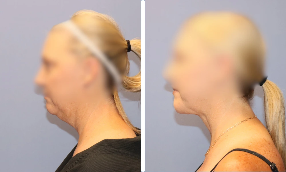 Neck-002 (4)