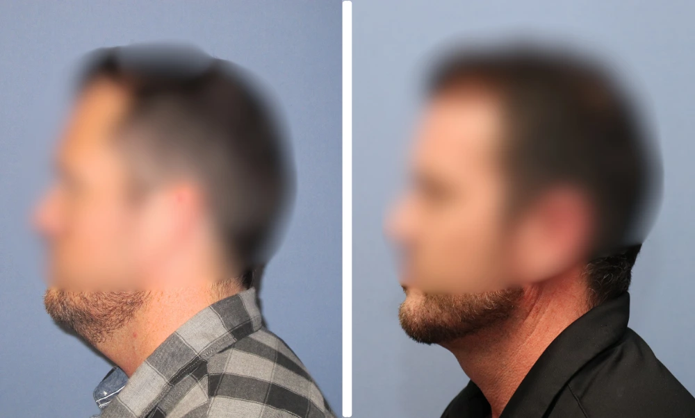 Neck-003 (1)