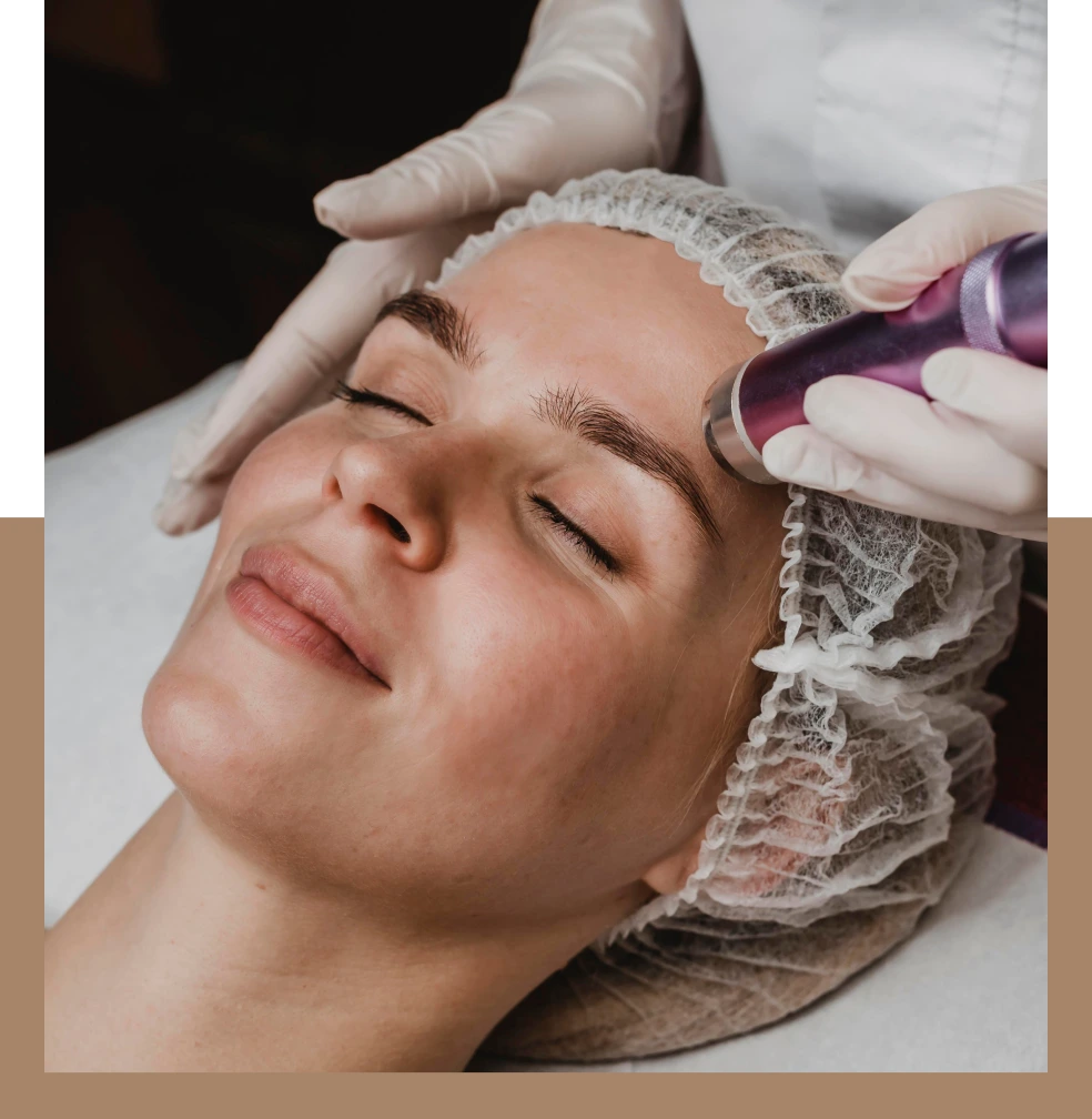Recovery after Coolpeel and Virtue Rf Microneedling