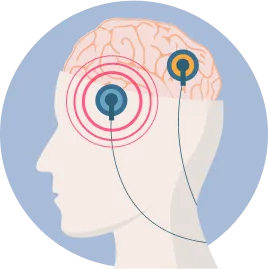 Diagram of head in profile showing brain with concentric circles and external coil placement for TMS