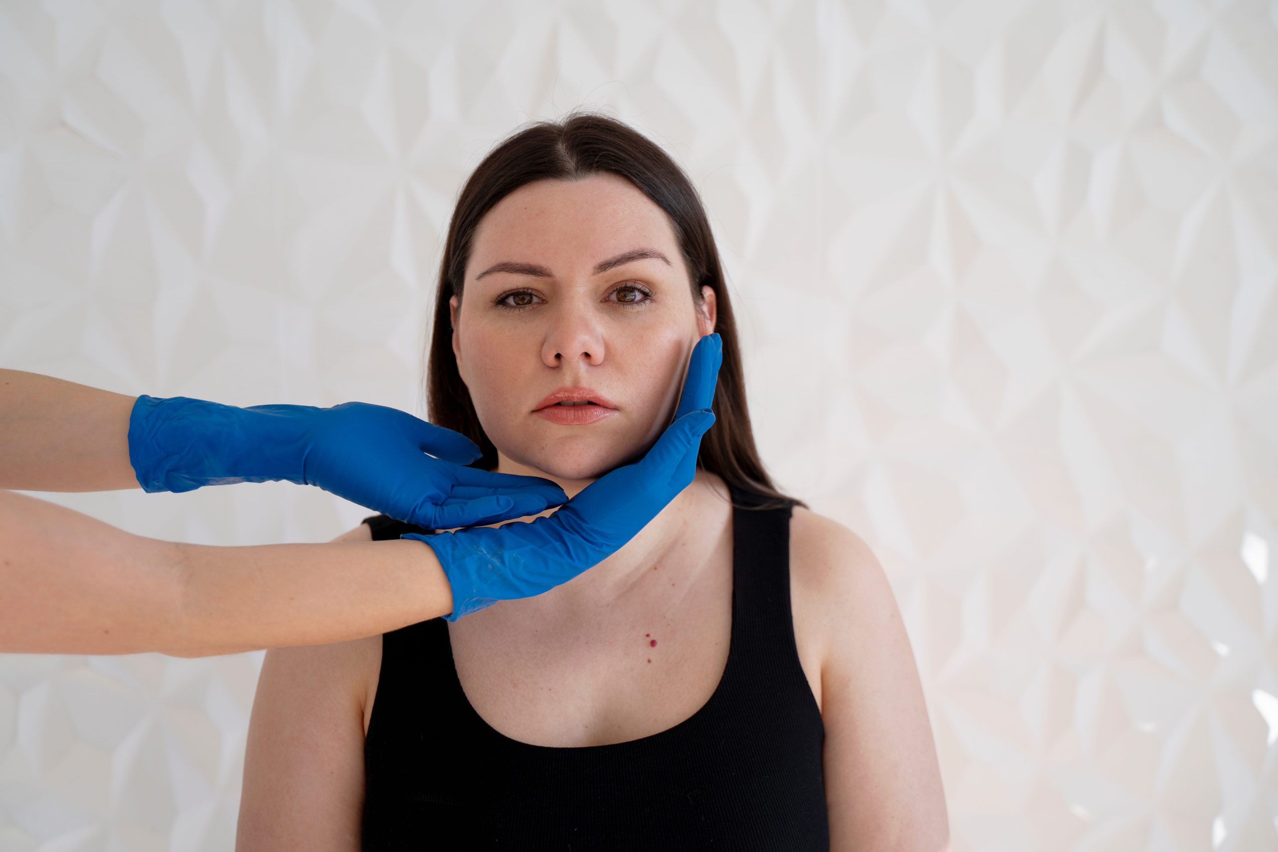 Does EMFACE Help with Nasolabial Folds Banner