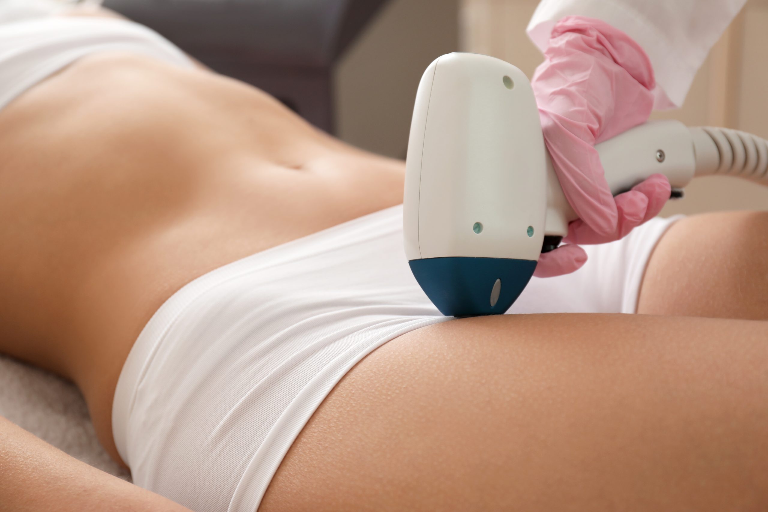 Clinician using laser hair removal device on patient's leg during Brazilian laser hair removal treatment
