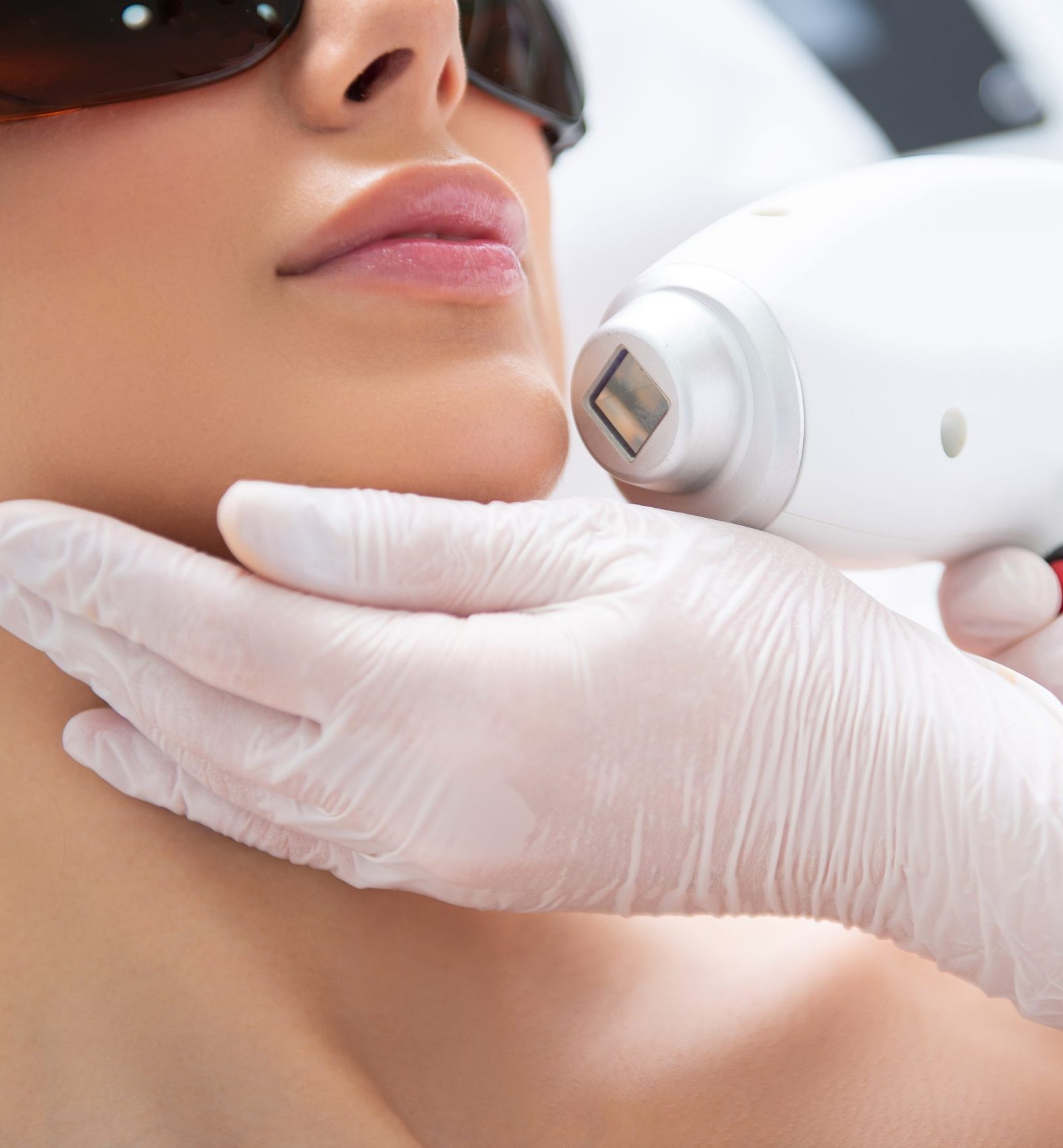 Clinician in protective gloves applying laser hair removal device to patient's chin while patient wears safety eyewear