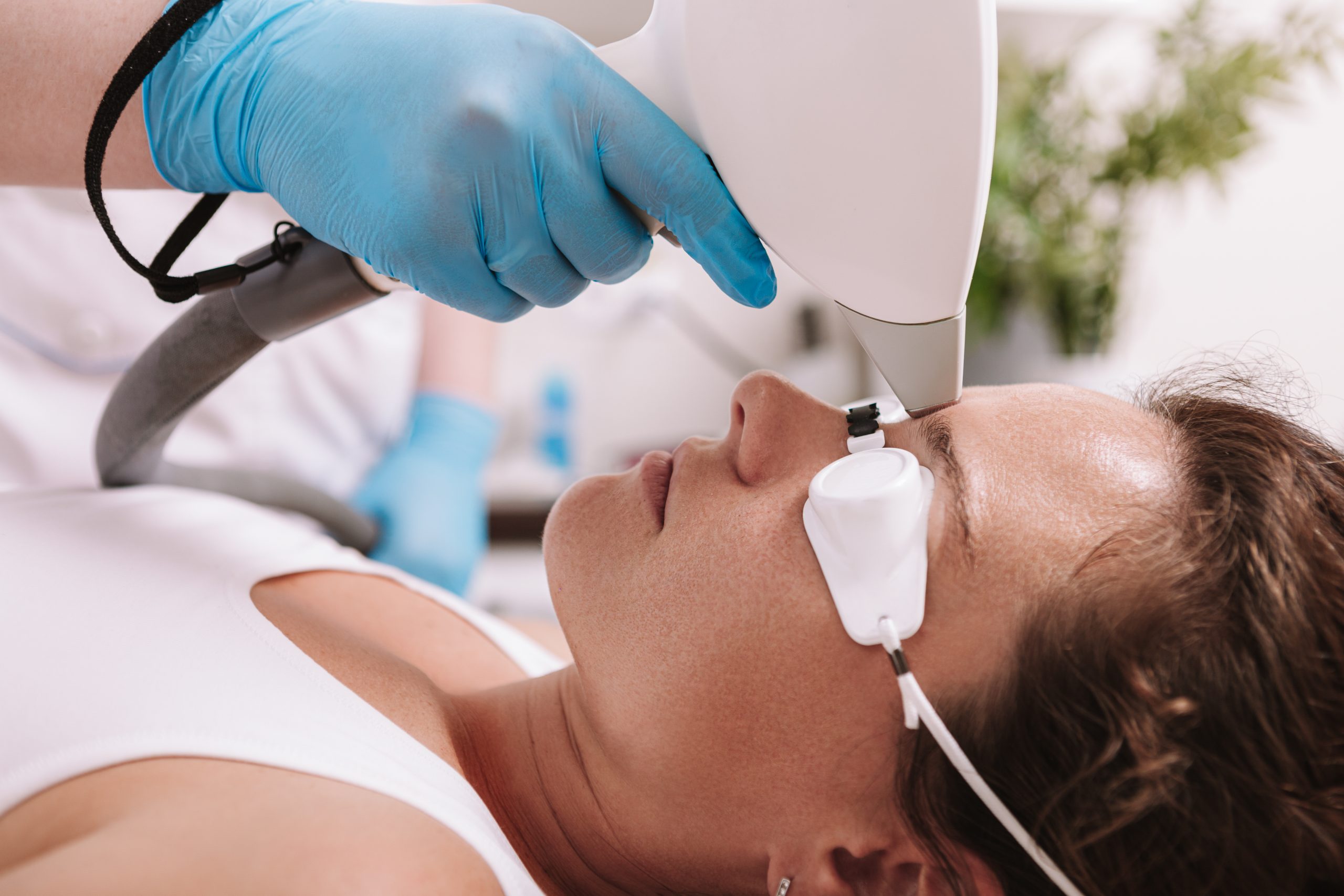 Practitioner in blue gloves using laser device on woman's eyebrow area during hair removal treatment