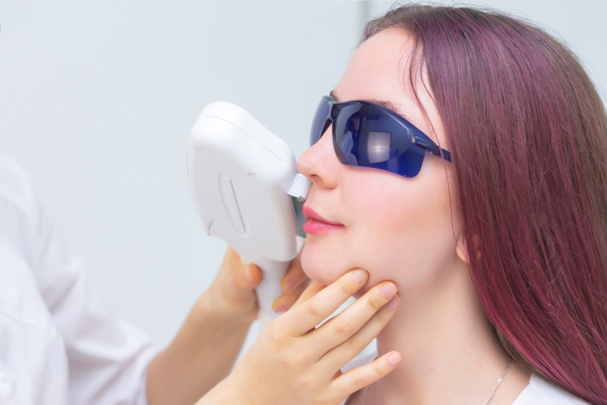 Woman wearing protective eyewear receiving laser hair removal treatment on upper lip area