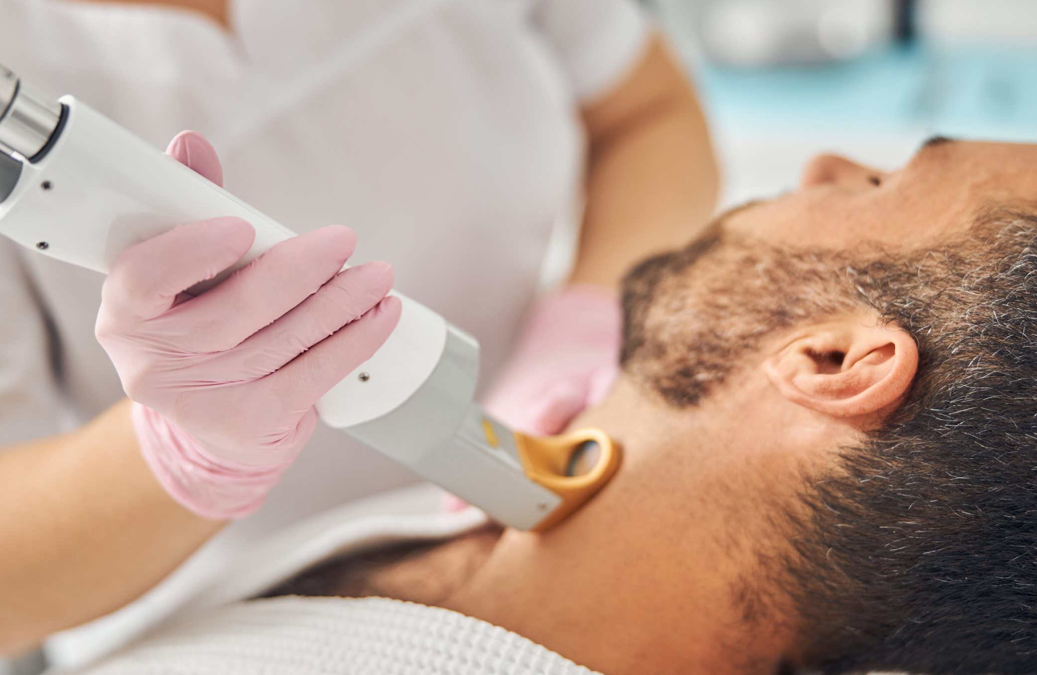 Practitioner in pink gloves using handheld laser device on patient's facial hair during laser hair removal treatment