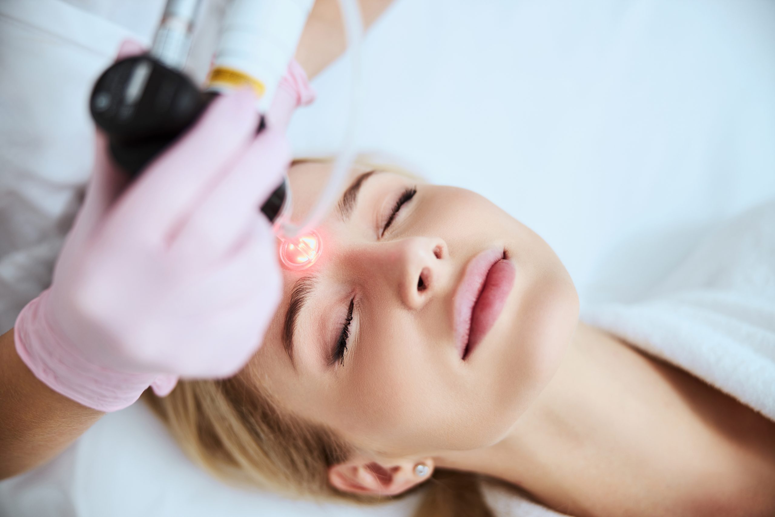 Urban Laser Denver Treatment Photo