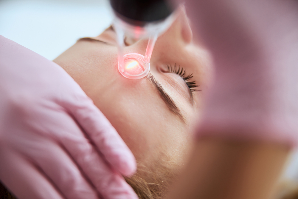 Dermatologist in latex gloves directing a pink laser device toward patient's face during CO2 laser treatment
