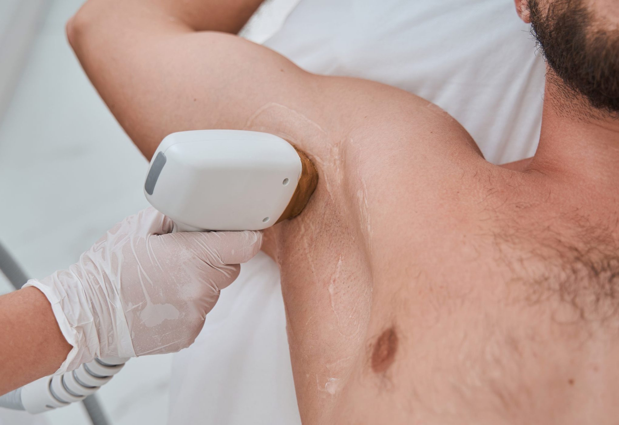 Technician in gloves applying laser hair removal device to man's shoulder