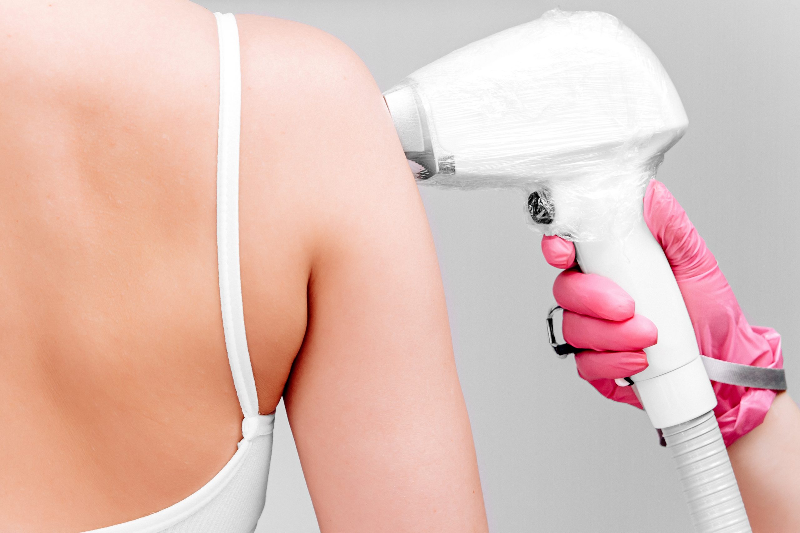 Practitioner in pink gloves using laser hair removal device on woman's arm
