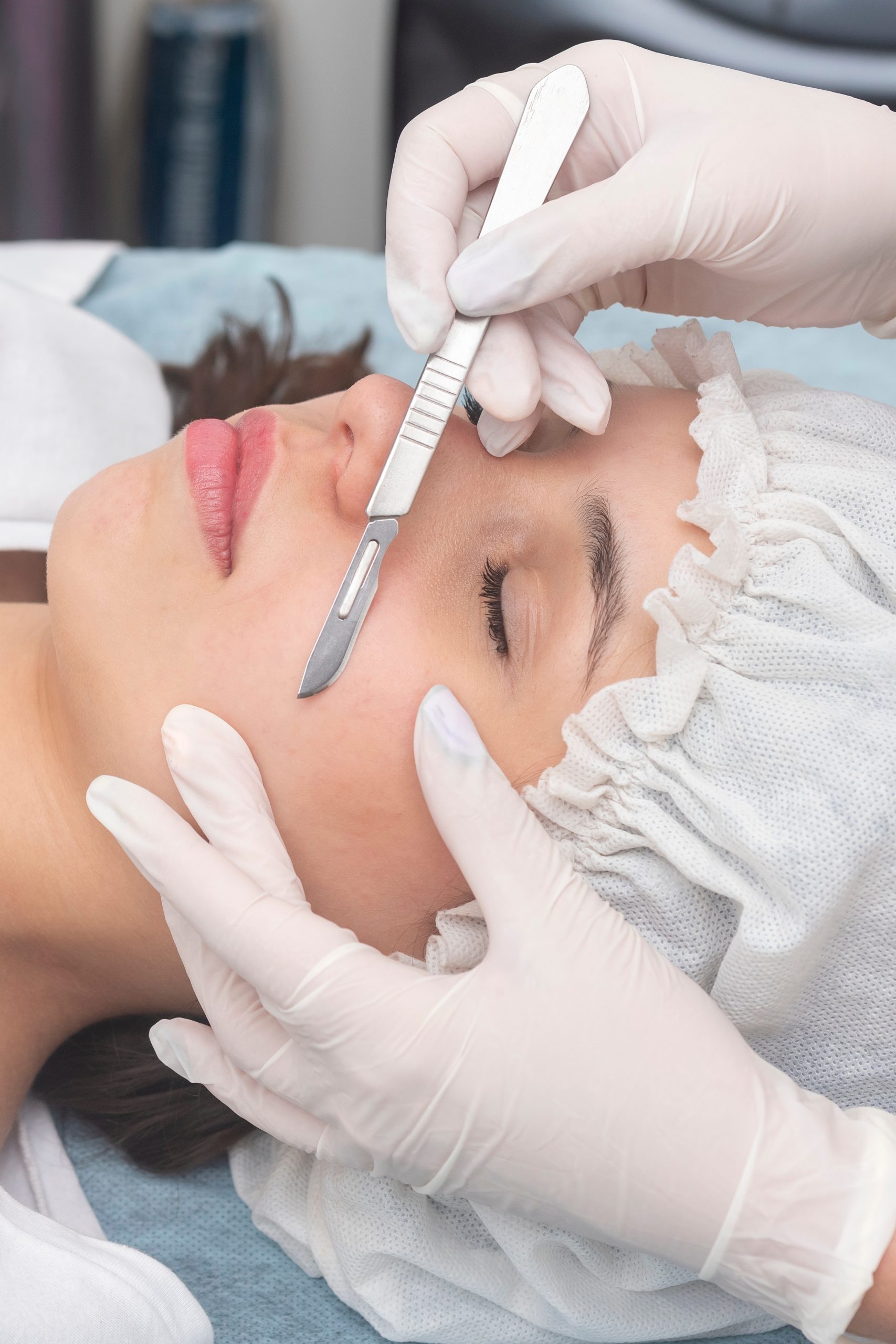 Aesthetician in gloved hands performing dermaplaning on patient's cheek with surgical blade