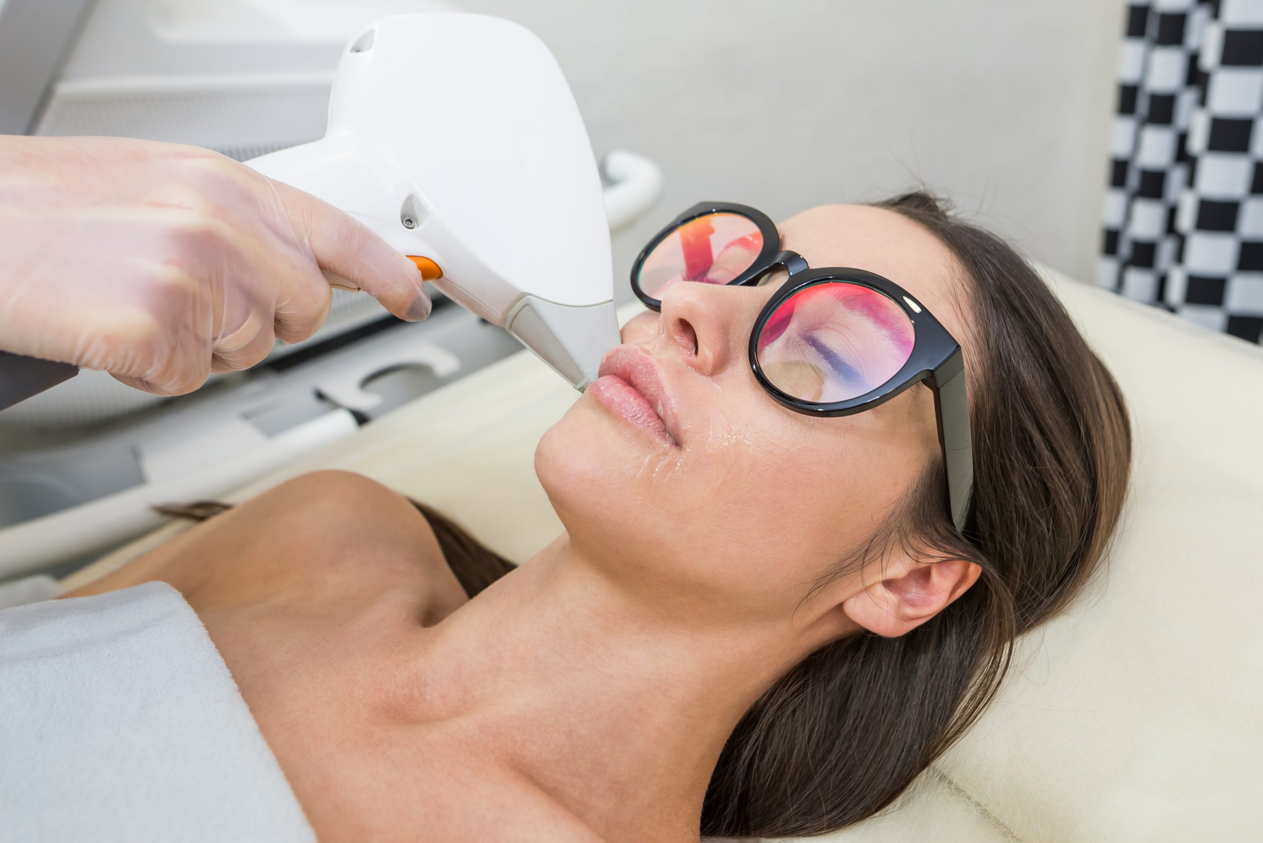 Woman wearing protective eyewear receiving facial laser hair removal treatment on her chin and upper lip area