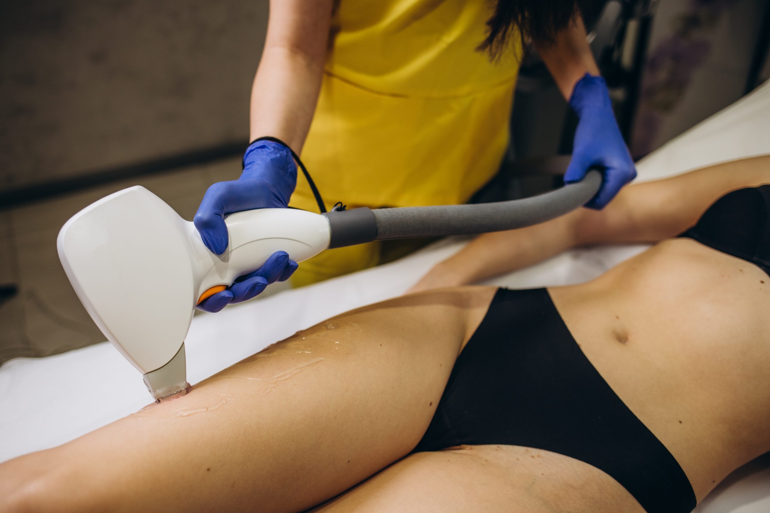 Technician in blue gloves using handheld laser device on patient's leg for hair removal treatment
