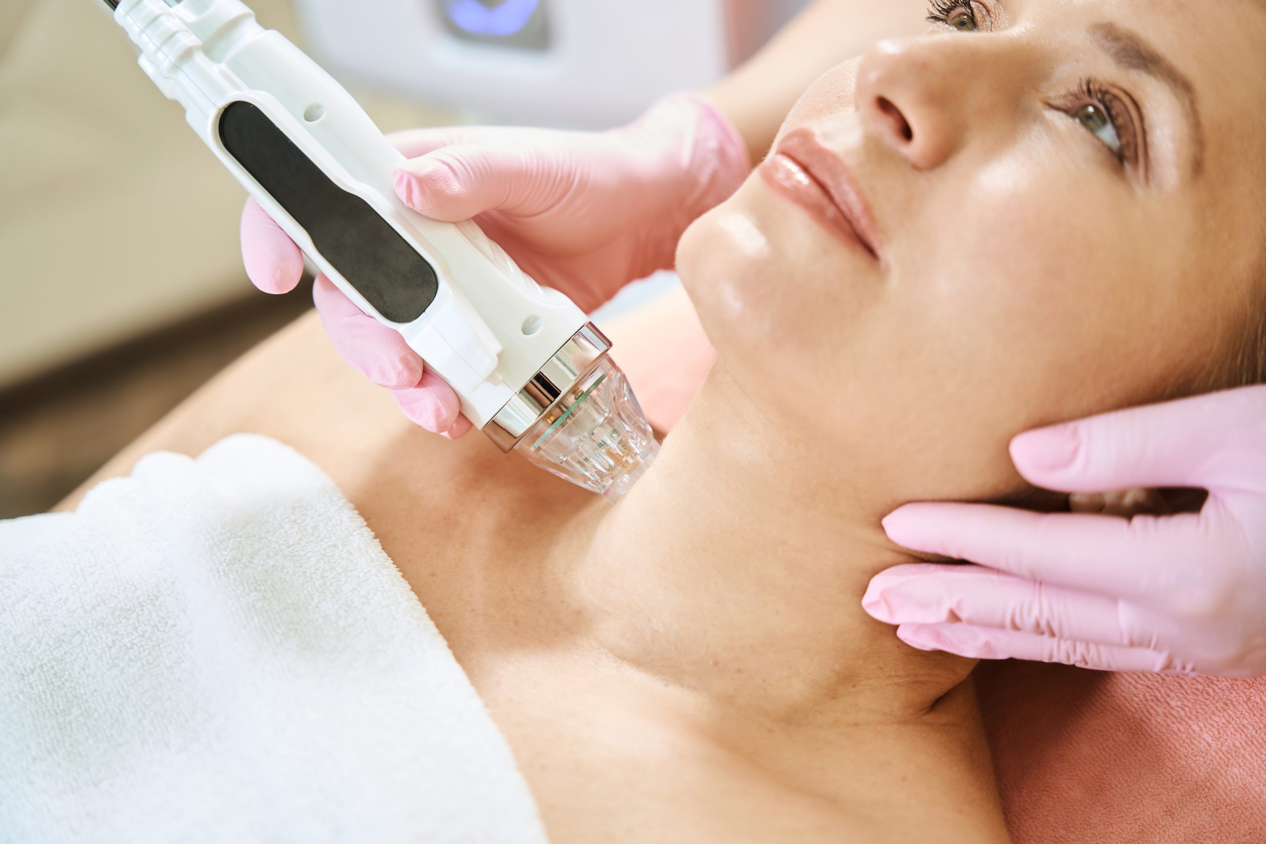 Cosmetologist performing RF microneedling treatment on patient's neck and jawline