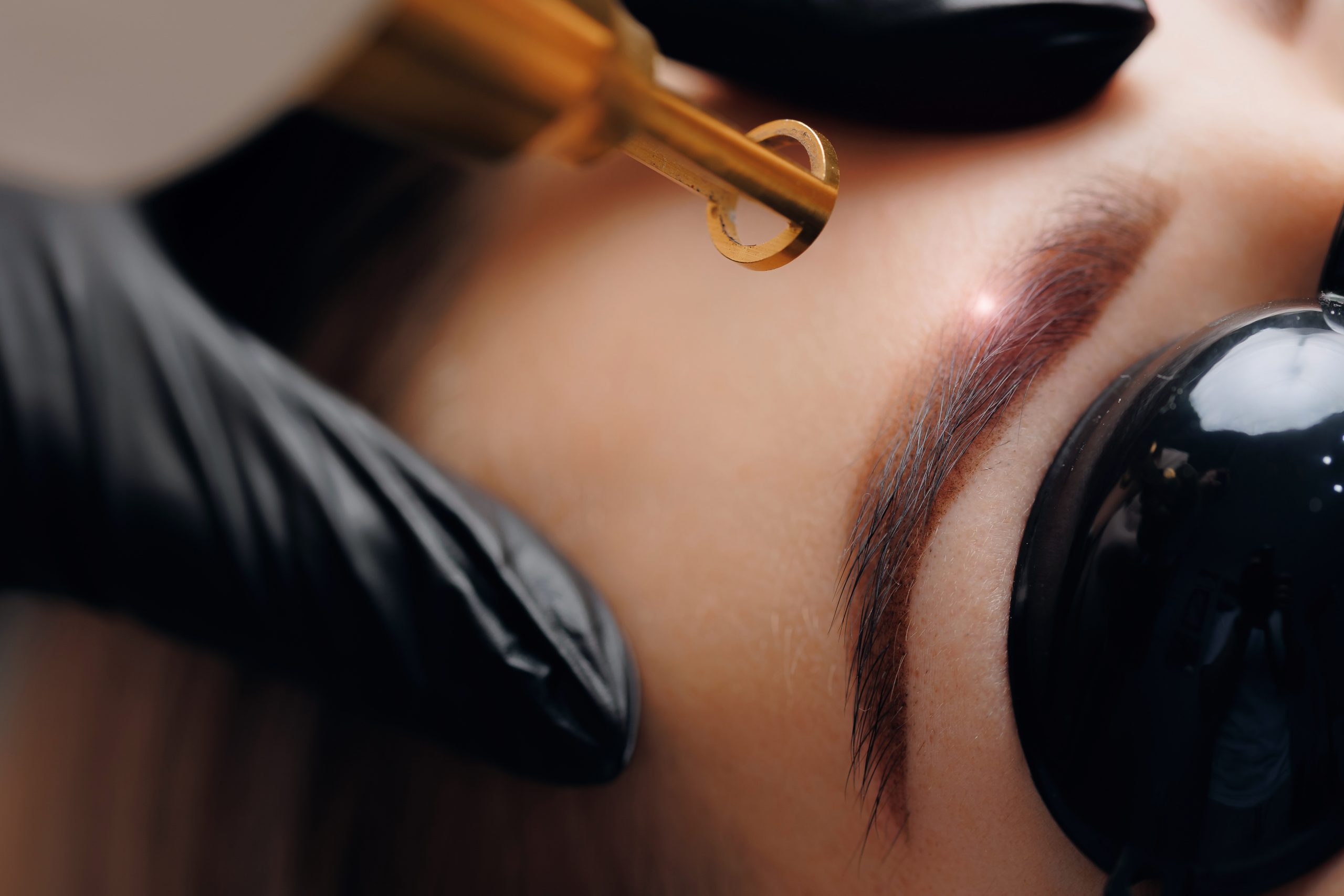 Laser hair removal treatment being applied to a woman's eyebrow area with a handheld device
