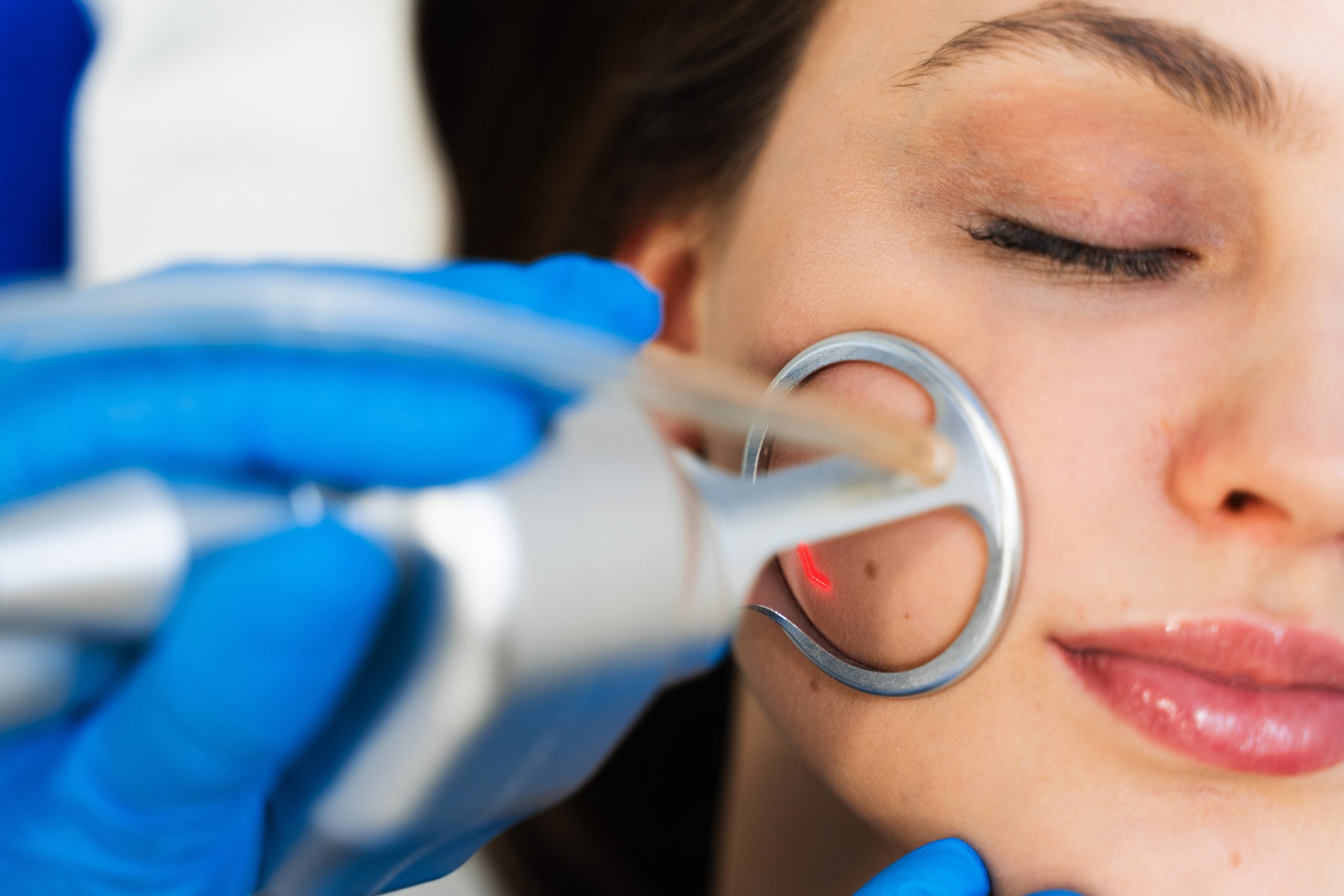 Cosmetologist performing CO2 laser resurfacing on patient's cheek with handheld laser device