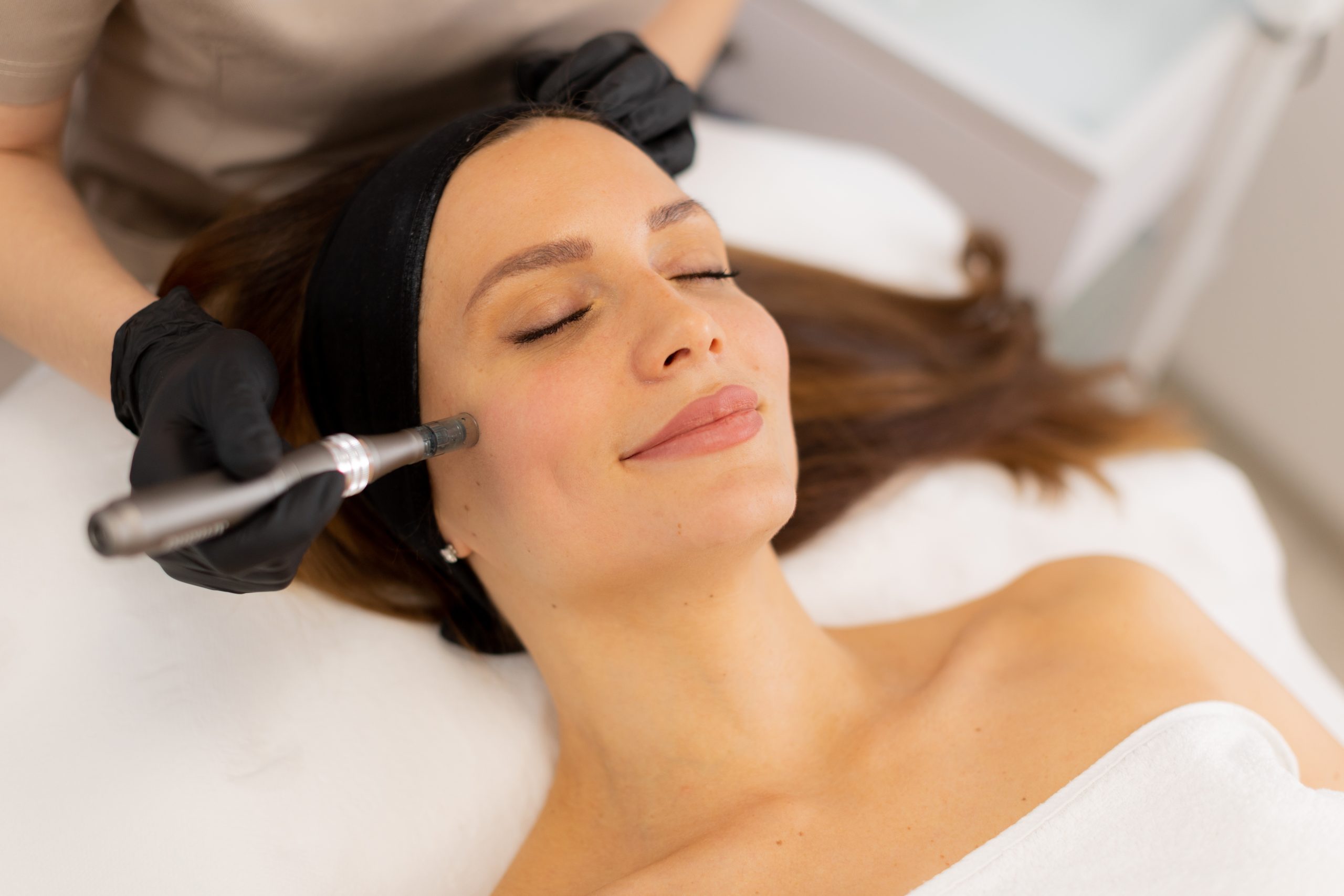Urban Laser Denver Treatment Photo