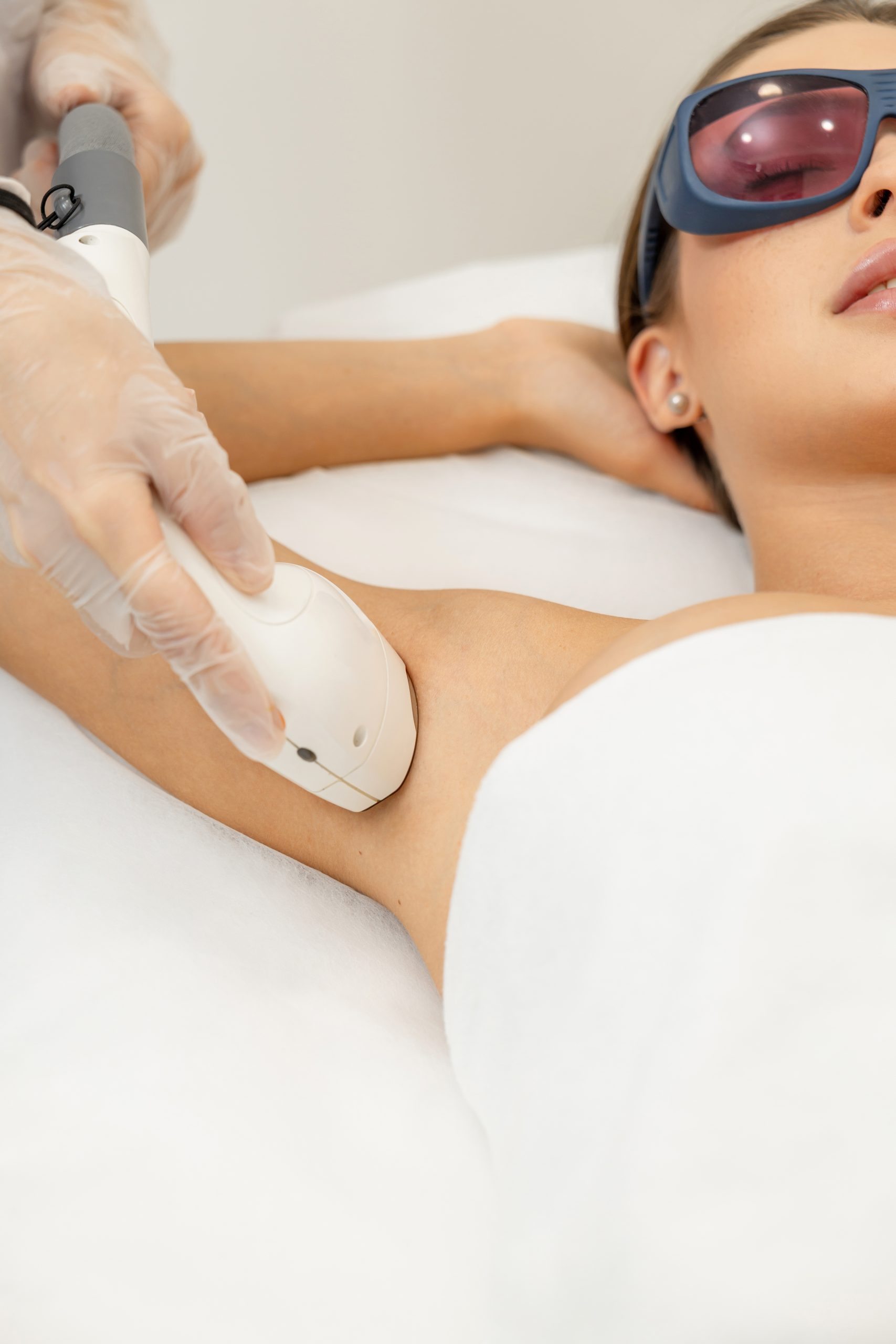 Clinician applying laser hair removal device to patient's underarm while patient wears protective eyewear