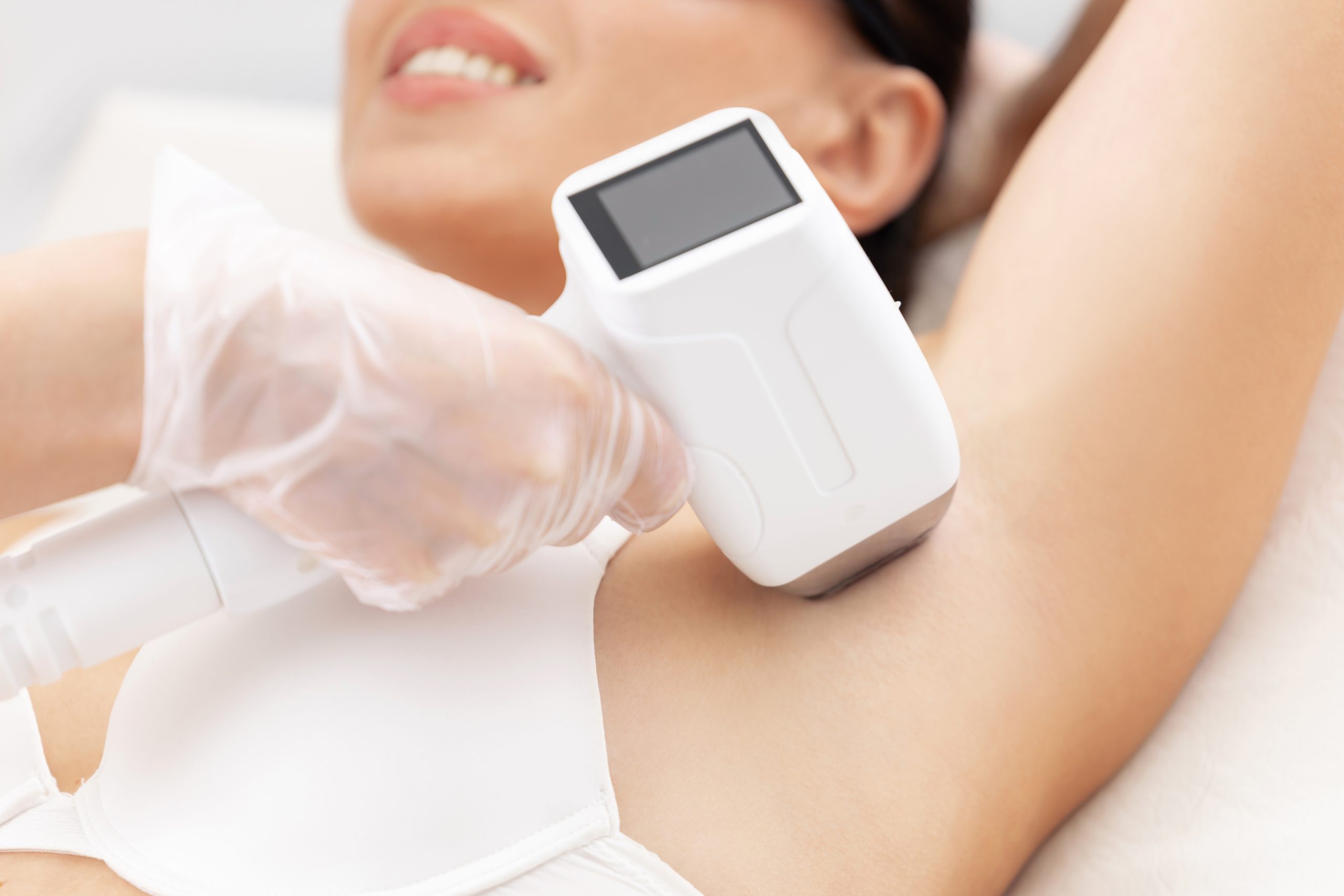 Practitioner applying laser hair removal device to patient's underarm