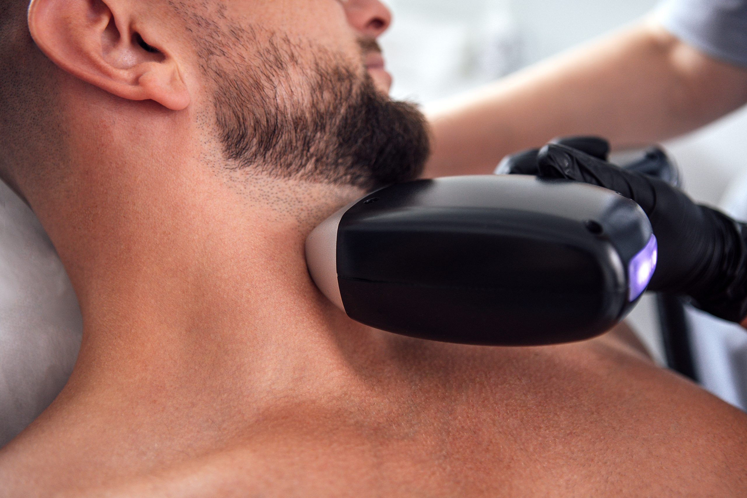 Clinician using laser hair removal device on man's neck and jawline
