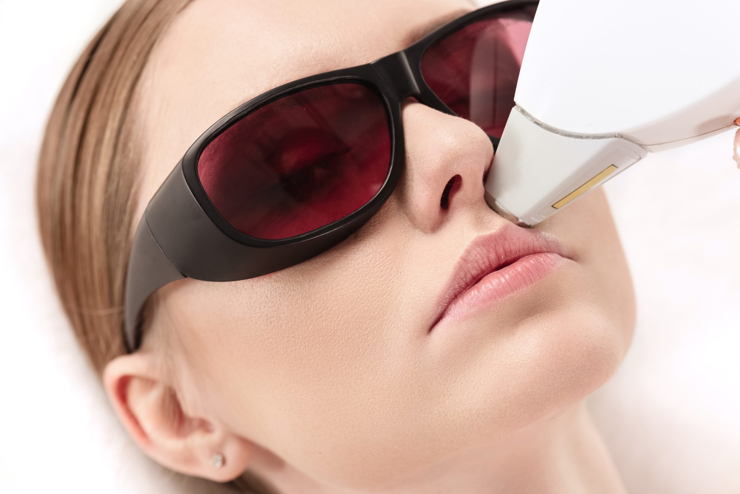 Woman wearing protective red-tinted goggles during laser hair removal treatment on her face
