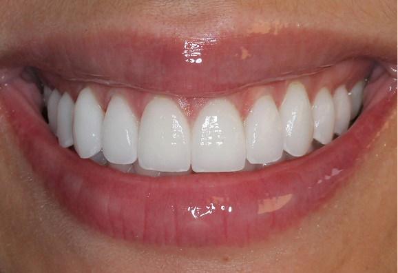 Signature Transformations - new gallery - image (2)