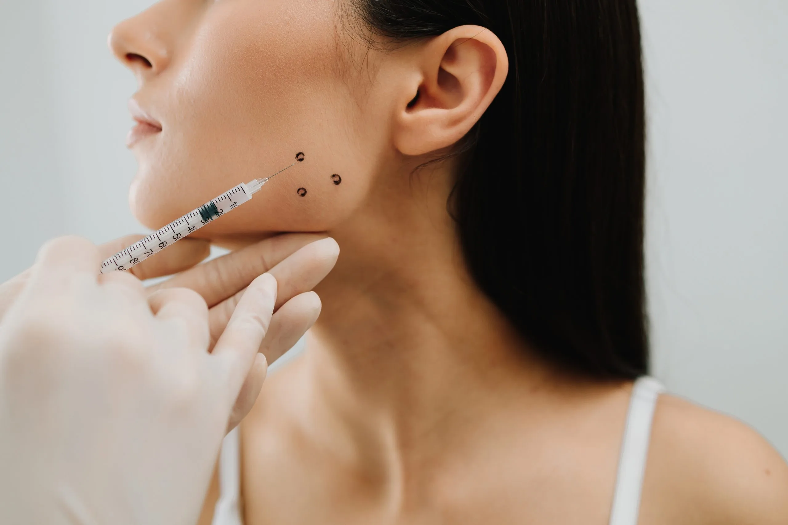 Practitioner marking injection sites on patient's cheek and jawline with measured syringe