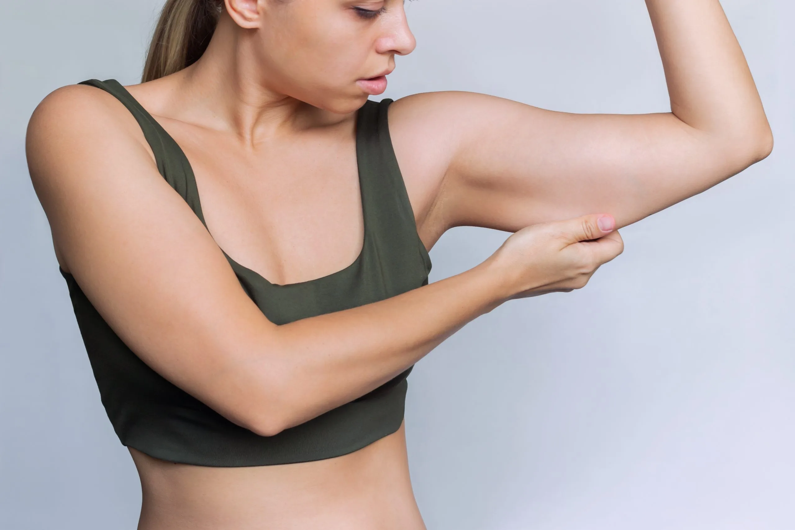 Woman pinching a small pocket of fat on her upper arm