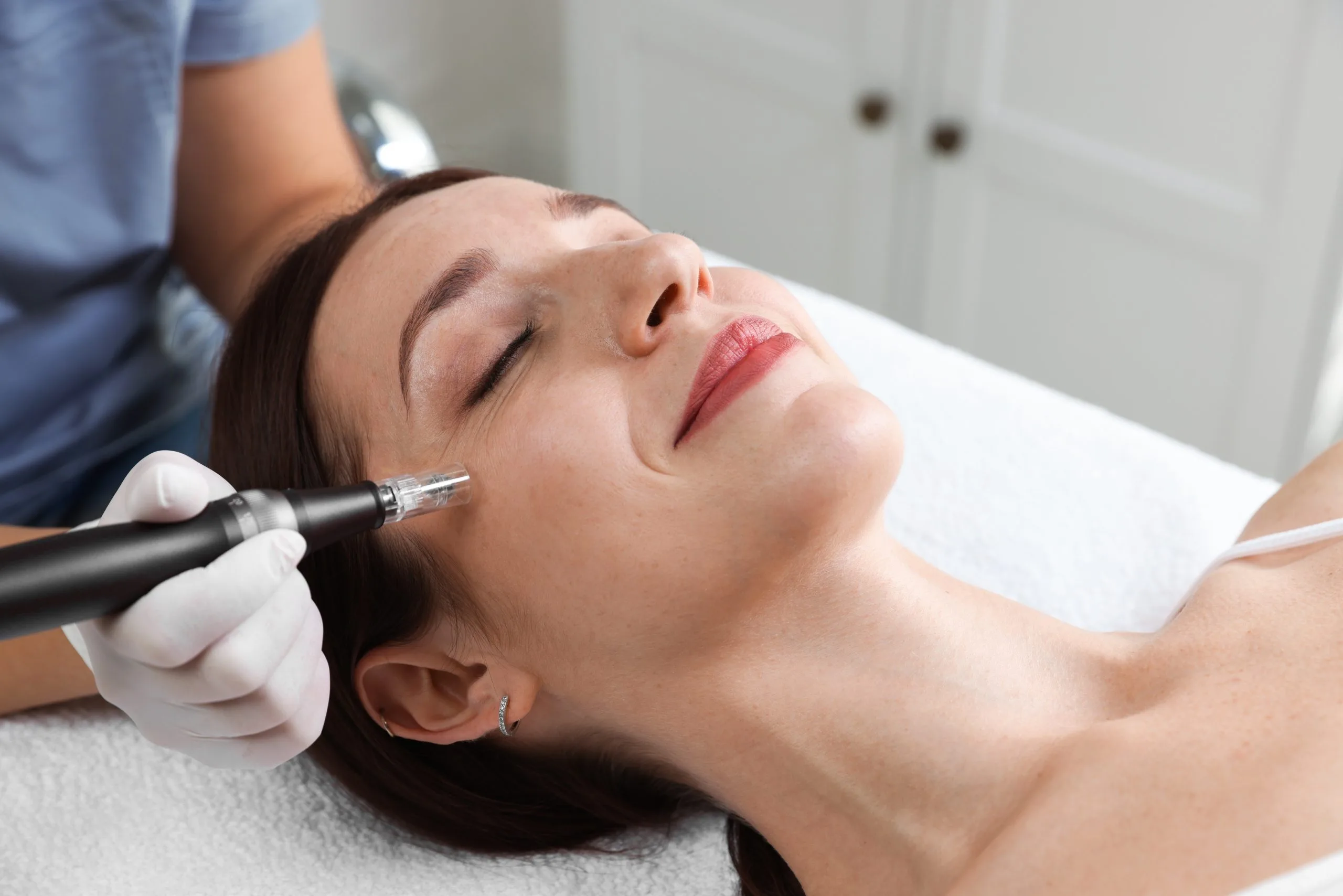 Woman,Undergoing,Microneedling,Procedure,In,Beauty,Salon,,Closeup