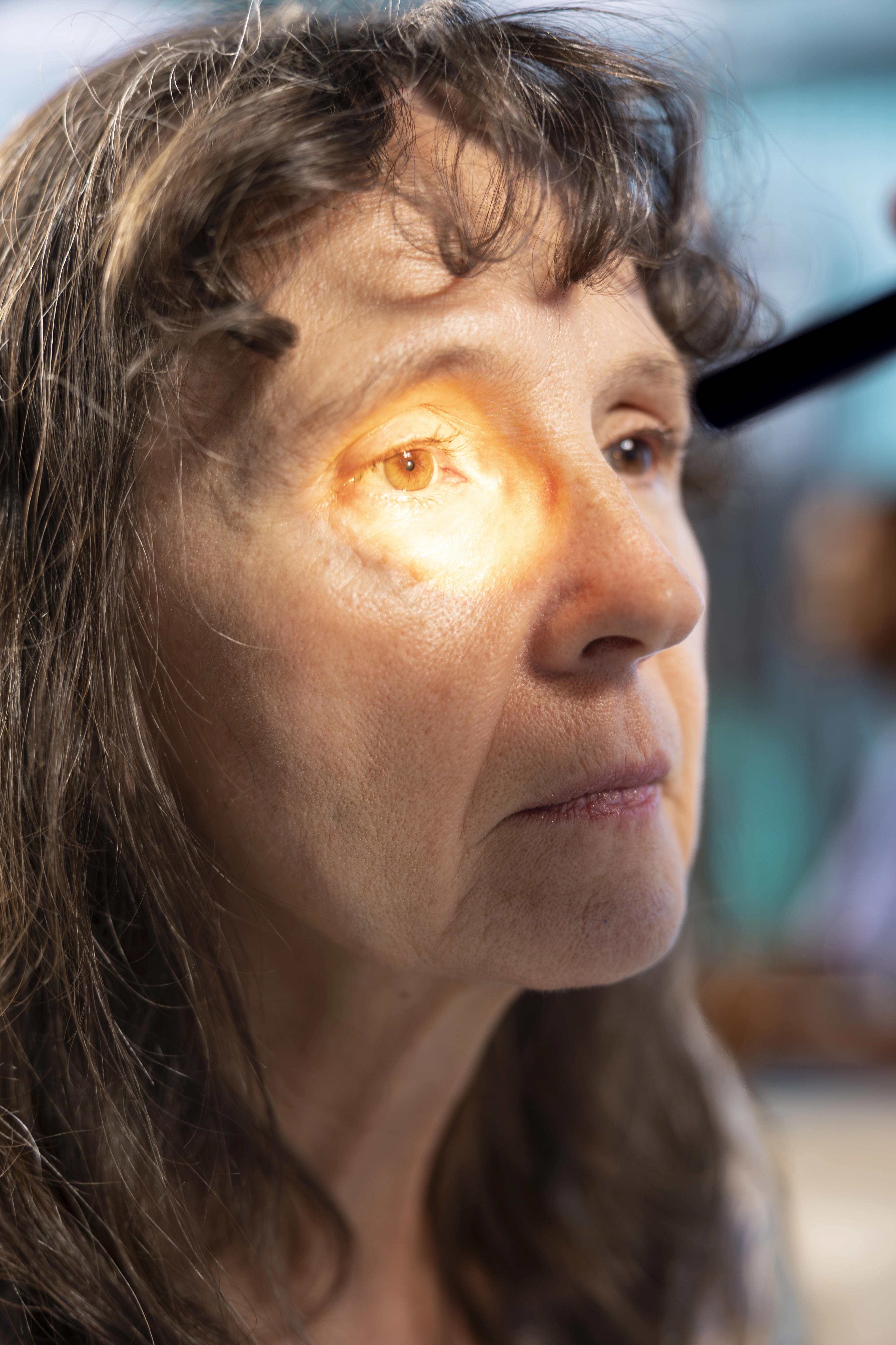 Clinician guiding a patient's eye movements