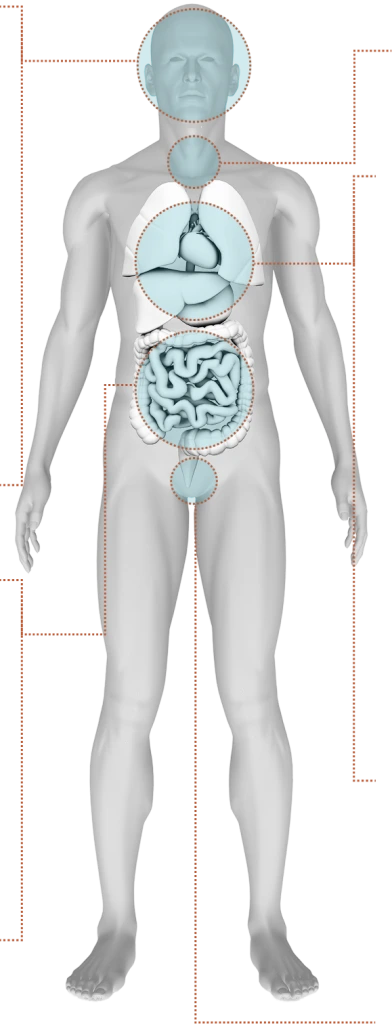 Medical diagram of human body highlighting brain, heart, and digestive organs affected by sleep apnea