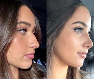 Before After mobile