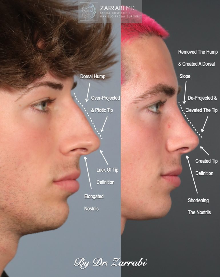 ML