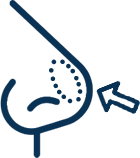 Icon showing bulbous nose tip with arrow indicating reshaping direction