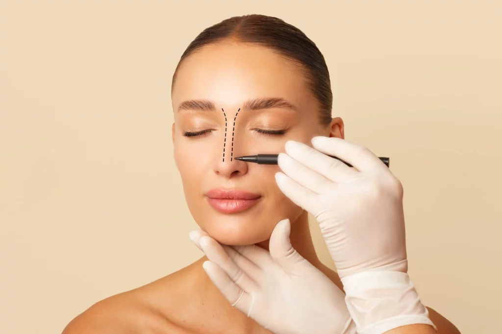Can cartilage move after rhinoplasty? Banner