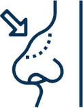 Icon showing dorsal nasal hump with arrow indicating reduction technique